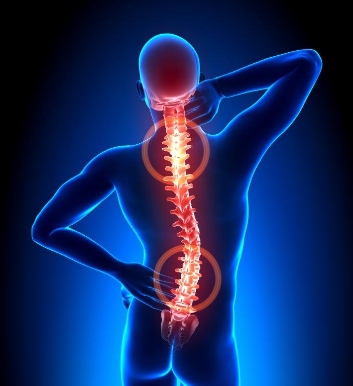Ból kręgosłupa – jak mogę sobie pomóc?